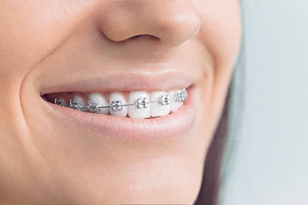 Best Wisdom Tooth Removal  in El Cenizo, TX